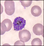 Plasmodium vivax