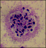 Toxoplasma gondii