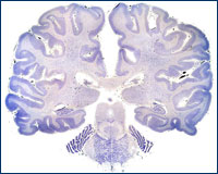 Section of Human Brain.