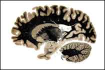 Section of human brain using fiber stain