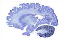 Section of human brain using cell stain