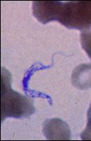 Trypanosomiasis, African.